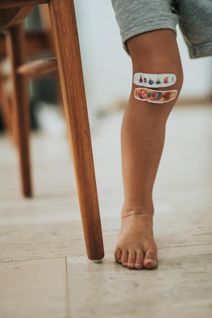 a boy with a bandaid on his knee.